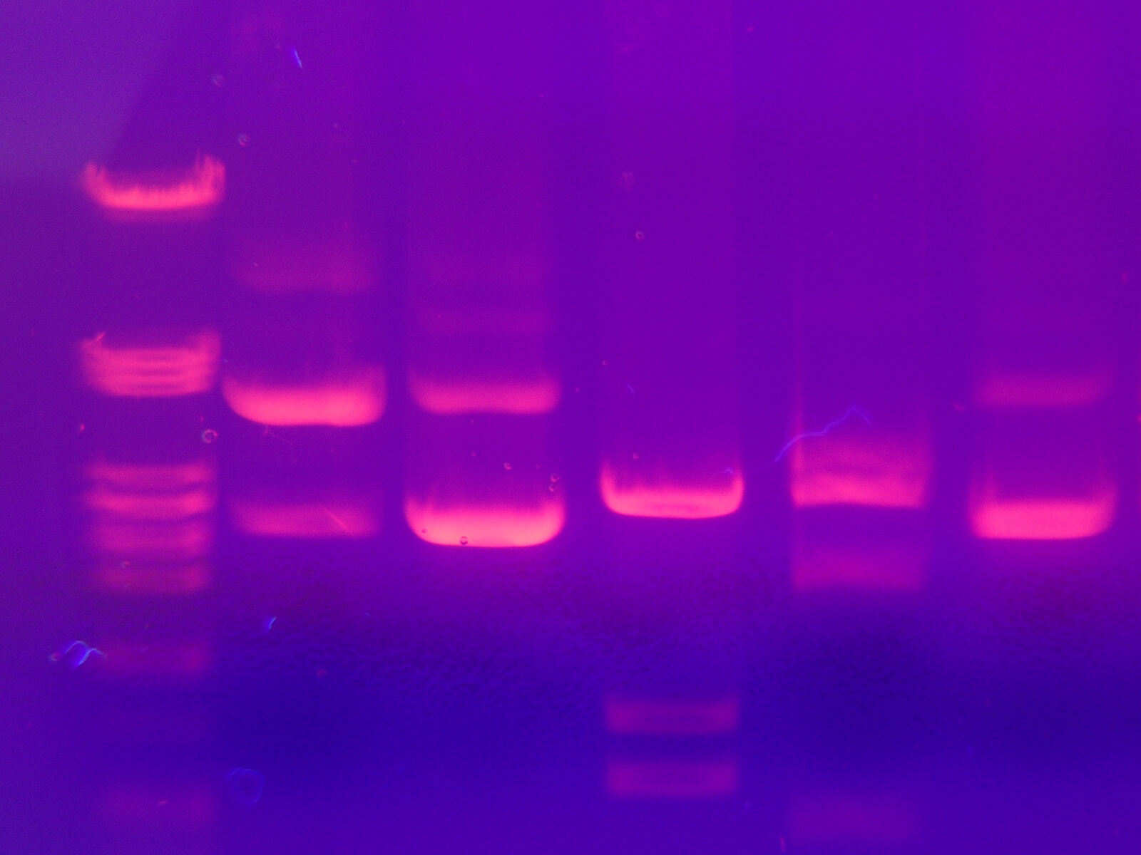 band of DNA visible in a gel electrophoresis experiment