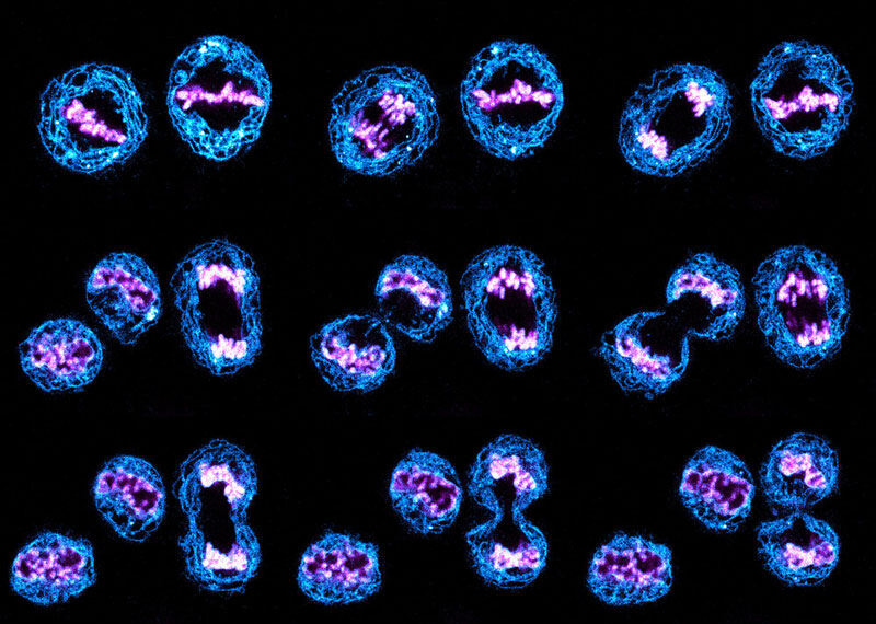 Mitosis in human cells